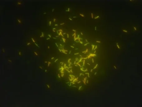 Result and Interpretation of Auramine- Rhodamine Staining