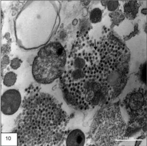 Positive staining of Viruses – Principle, Procedure, Result