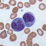 Monocytes - Definition, Structure, Types, Functions