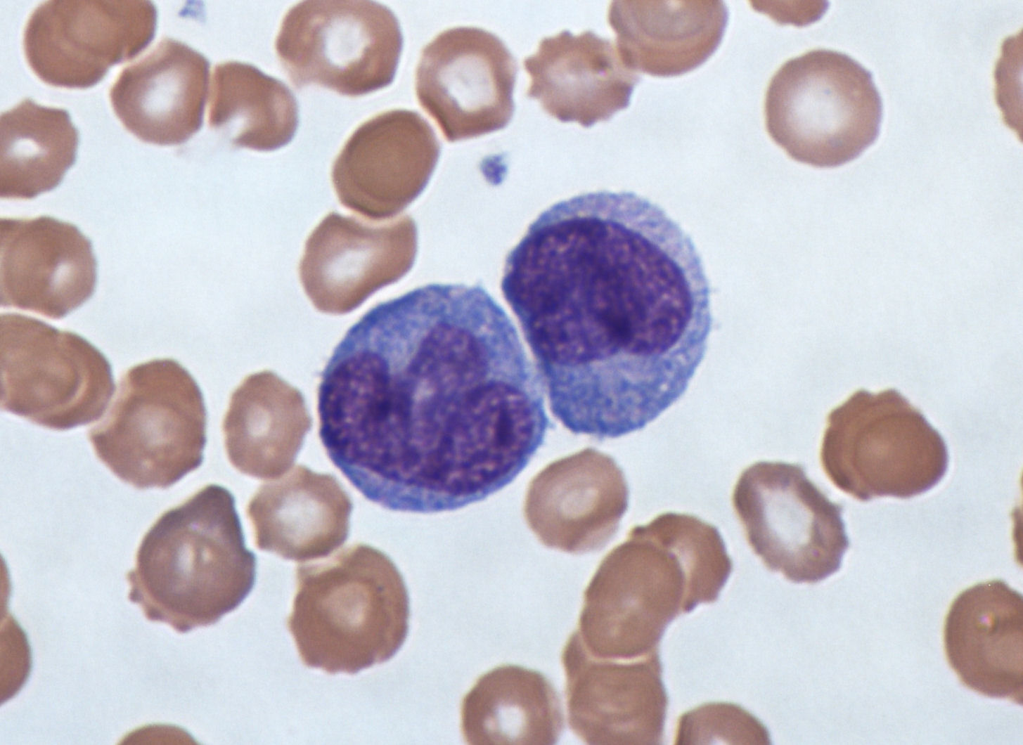 Monocytes - Definition, Structure, Types, Functions