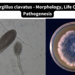 Aspergillus clavatus - Morphology, Life Cycle, Pathogenesis