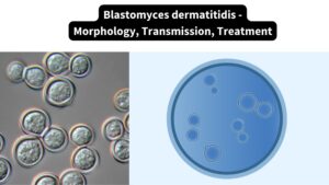 Blastomyces dermatitidis – Morphology, Transmission, Treatment