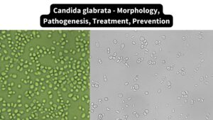 Candida glabrata – Morphology, Pathogenesis, Treatment, Prevention