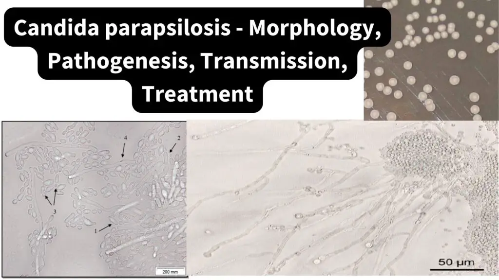 Candida Parapsilosis Morphology Pathogenesis Transmission Treatment Biology Notes Online 5311