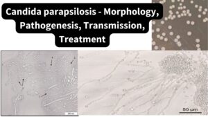 Candida parapsilosis – Morphology, Pathogenesis, Transmission, Treatment
