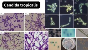 Candida tropicalis – Morphology, Pathogenesis, Transmisssion, Treatment