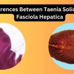 Differences Between Taenia Solium and Fasciola Hepatica