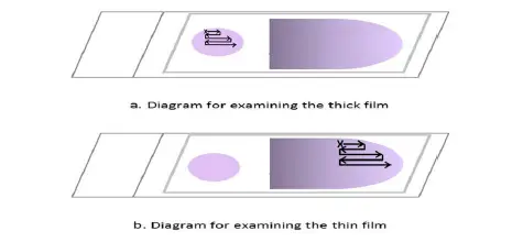 Thick and Thin Blood Smear