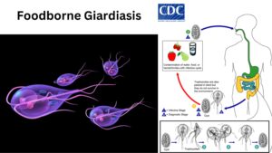 Foodborne Giardiasis – Definition, Pathogenesis, Contamination
