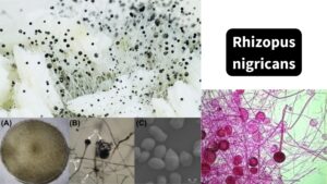 Rhizopus nigricans – Life Cycle, Repoduction, Morphology, Pathogenesis