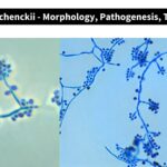 Sporothrix schenckii - Morphology, Pathogenesis, Transmission