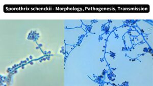 Sporothrix schenckii – Morphology, Pathogenesis, Transmission