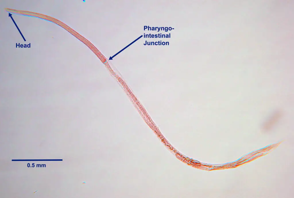 Strongyloides stercoralis: Parasitic adult female (stained)
