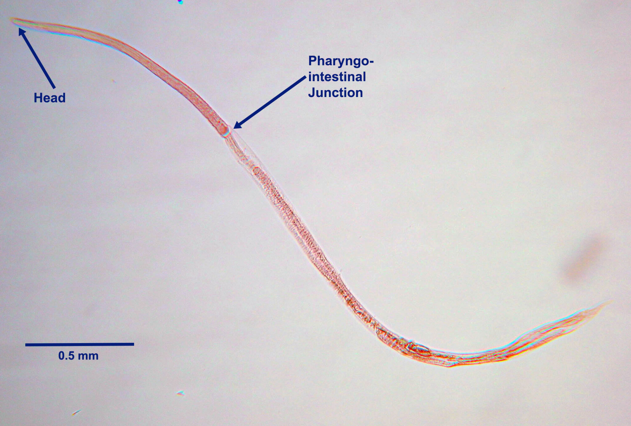 Strongyloides stercoralis (Parasitic Roundworm) - Biology Notes Online