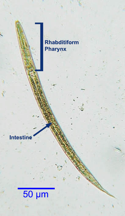 Strongyloides stercoralis: Rhabditiform first stage larva