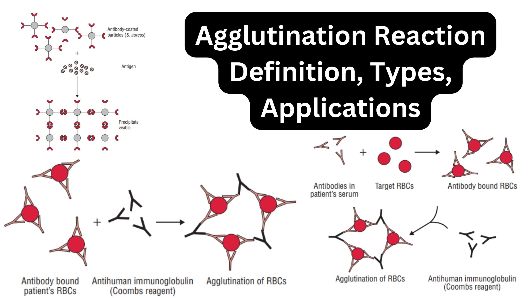 Agglutination Reaction - Definition, Types, Mechanism, Applications