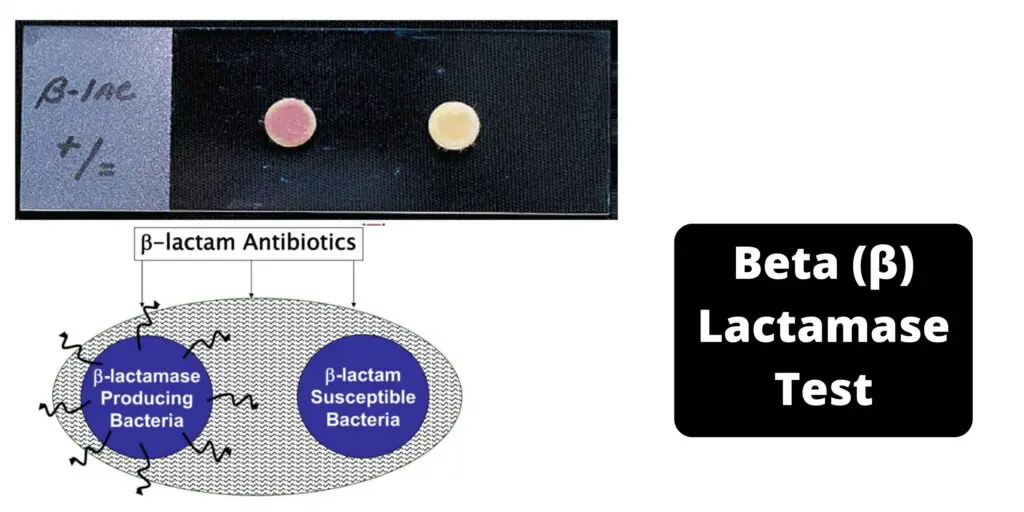 Beta (β) Lactamase Test - Principle, Procedure, Results - Biology Notes ...