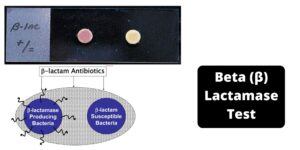 Beta (β) Lactamase Test – Principle, Procedure, Results