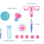 In Vitro Fertilization - Definition, Principle, Procedure, Applications