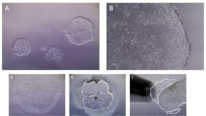 Stem cell culture – Definition, Types, Application, Preparation