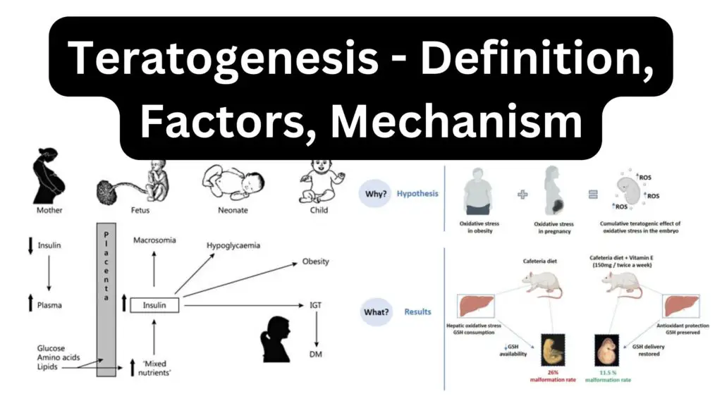 Teratogenesis - Definition, Factors, Mechanism - Biology Notes Online