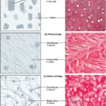 Types of Cartilage