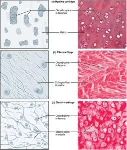 Differences Between Hyaline cartilage, Elastic, and Fibrocartilage