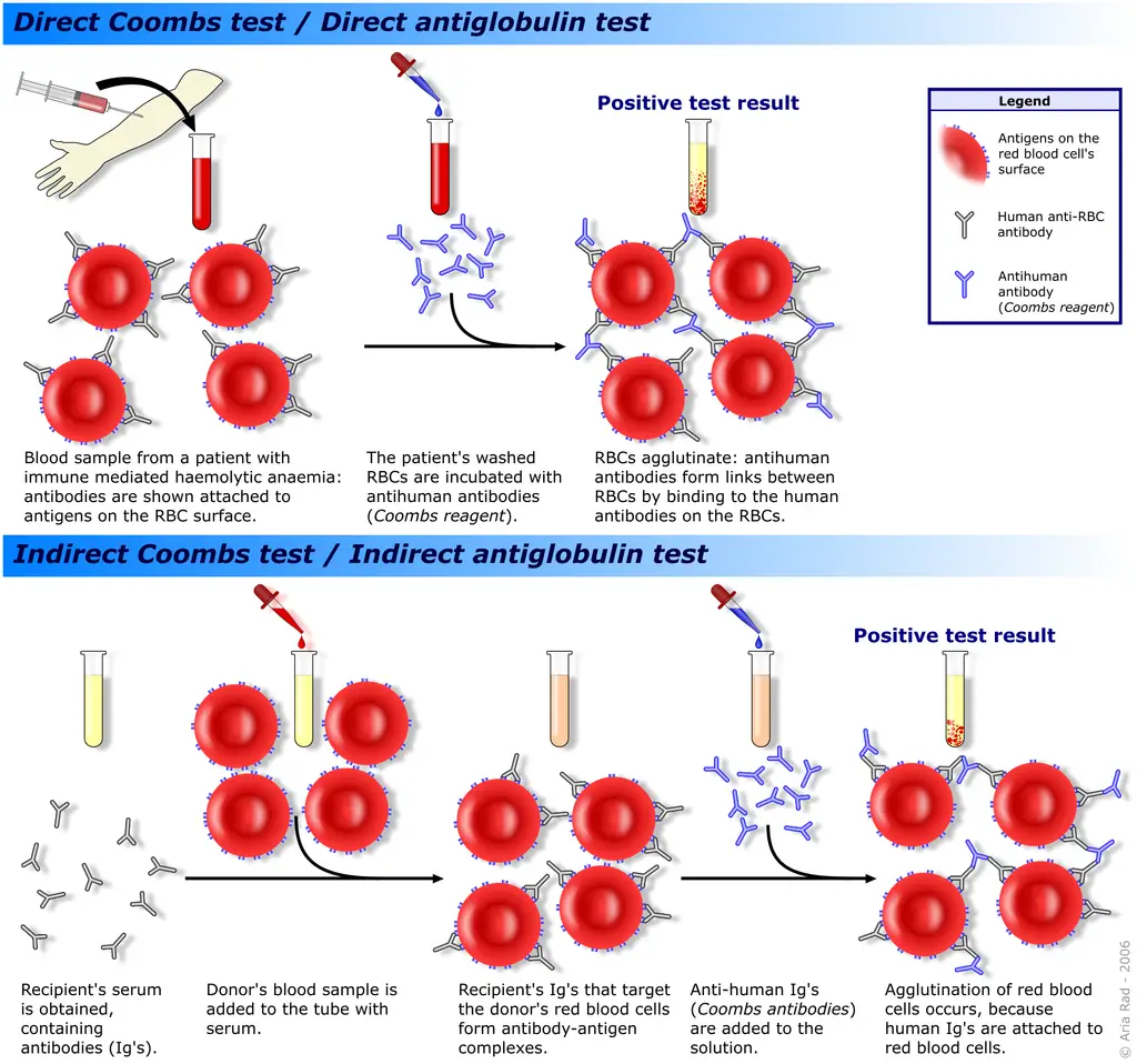 Coomb’s Test - Direct and Indirect Coomb’s Test