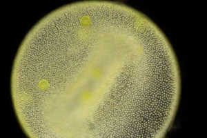 Volvox Under Microscope