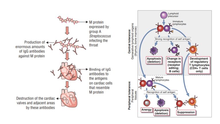 Autoimmunity - Definition, Types, Tolerance, Pathogenesis, Mechanisms