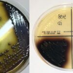 Bile Esculin Agar (BEA) - Principle, Composition, Preparation, Results, Uses