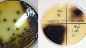 Bile Esculin Agar (BEA) – Principle, Composition, Preparation, Results, Uses