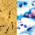 Chlamydia Under the Microscope