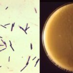 Clostridium Under Microscope