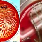 Columbia Blood Agar Base w/ Hemin - Composition, Preparation, Principle, Result, Uses