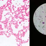 E. Coli Under the Microscope