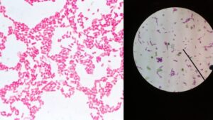 E. Coli Under The Microscope