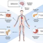 Autoimmune Disease - Definition, Types, Diagnosis, Treatment, Examples