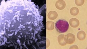 Lymphocytes – Definition, Development, Types and Functions