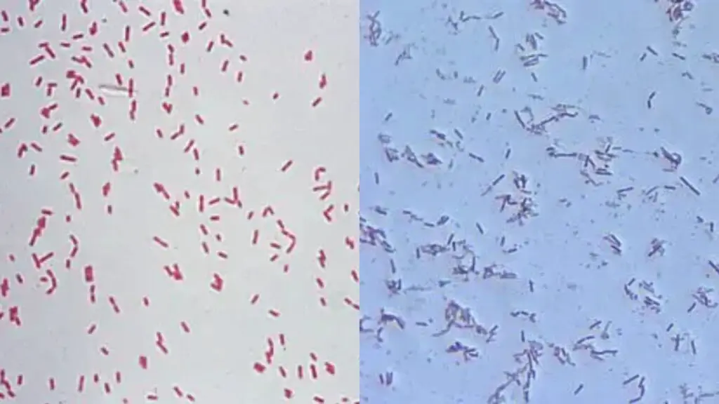 Pseudomonas Aeruginosa Under Microscope (Gram Staining) - Biology Notes ...