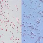 Pseudomonas Aeruginosa Under Microscope (Gram Staining)