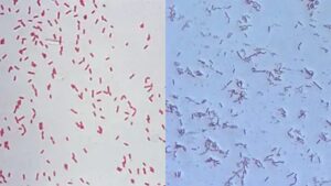 Pseudomonas Aeruginosa Under Microscope (Gram Staining)