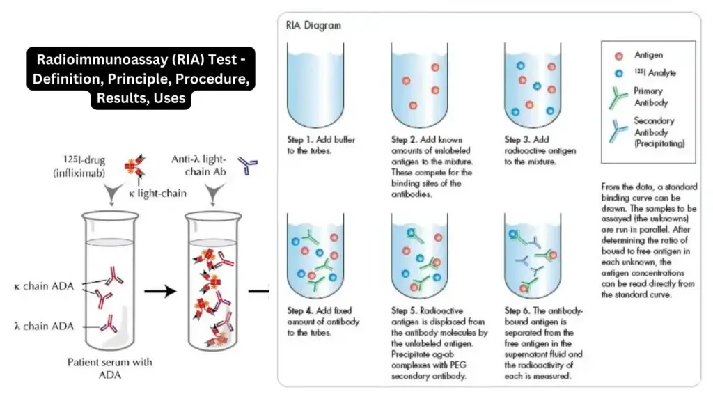 Radioimmunoassay (RIA) Test - Definition, Principle, Procedure, Results ...