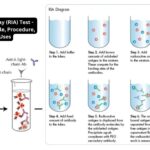 Radioimmunoassay (RIA) Test - Definition, Principle, Procedure, Results, Uses