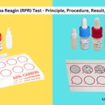 Rapid Plasma Reagin (RPR) Test - Principle, Procedure, Result, Applications