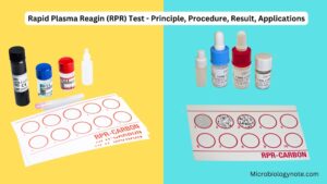 Rapid Plasma Reagin (RPR) Test – Principle, Procedure, Result, Applications