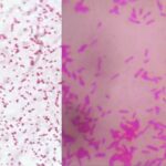 Salmonella Under Microscope