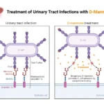 Treatment of Urinary Tract Infections with D-Mannose