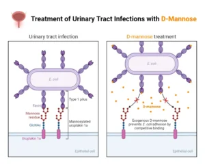 Urinary Tract Infection (UTI) – Pathogenesis, Treatments, Diagnosis, Prevention