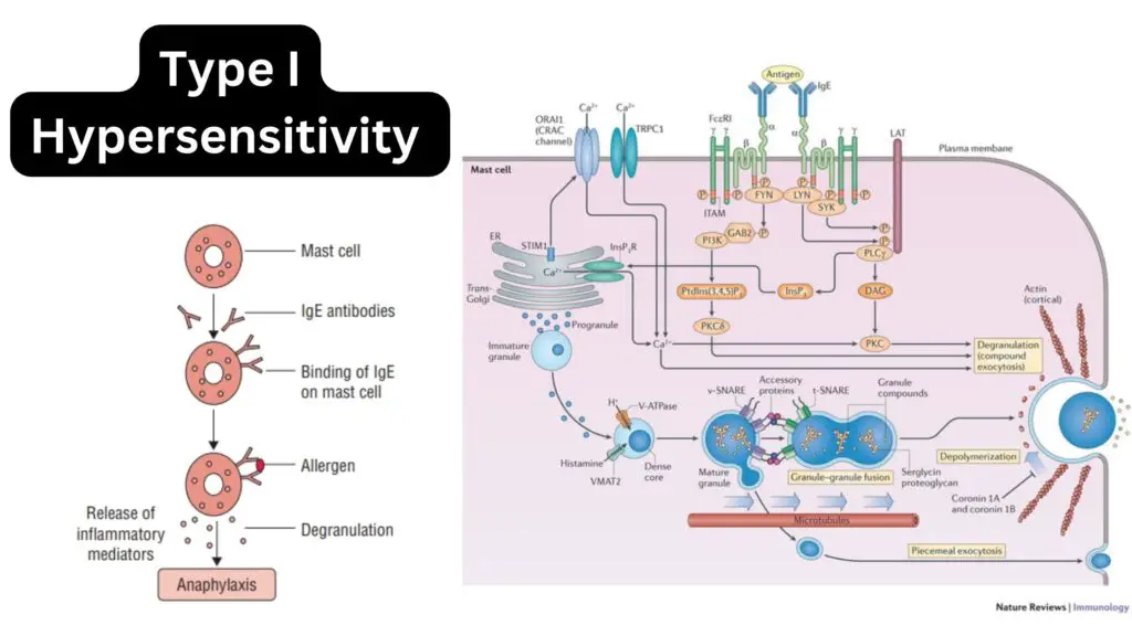 Type 1 (Anaphylactic) Hypersensitivity Reaction - Definition, Mechanism ...